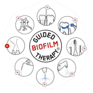 Les étapes du traitement Guided Biofilm Therapy