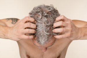 greffe de cheveux