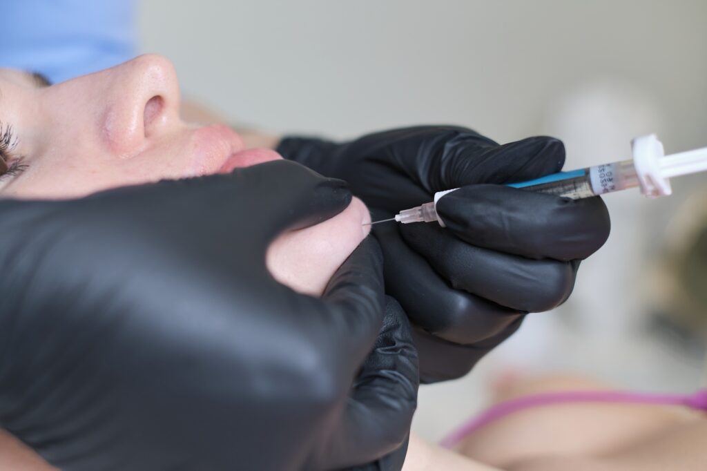 injections acide hyaluronique